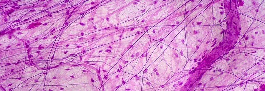 Connective Tissue Quiz Multiple Choice